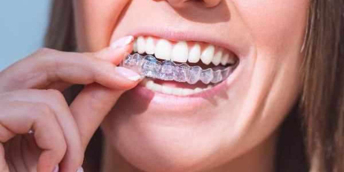 Handling Orthodontic Emergencies the Right Way in Bromsgrove